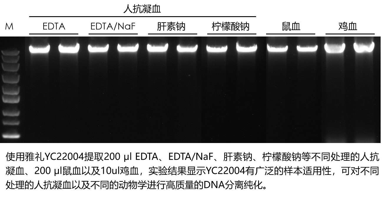 Blood Genomic DNA-case1